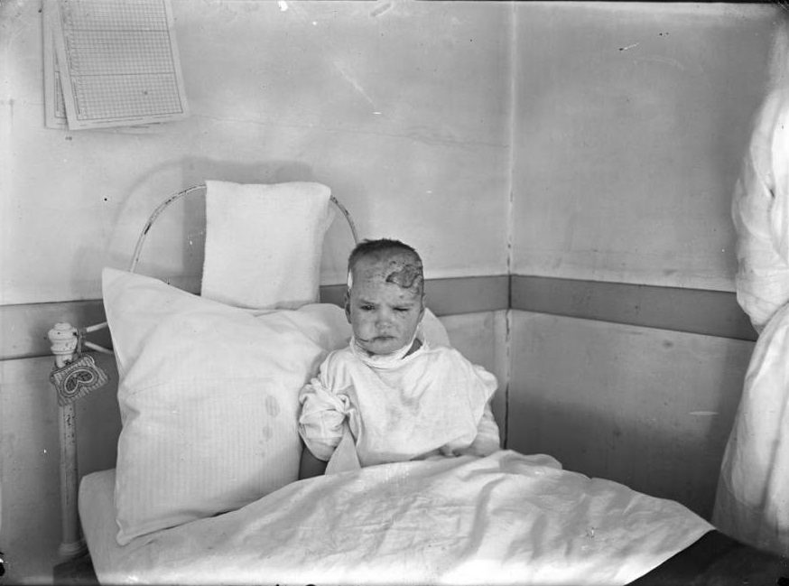 A child, injured in the explosion, recuperates in a hospital bed.