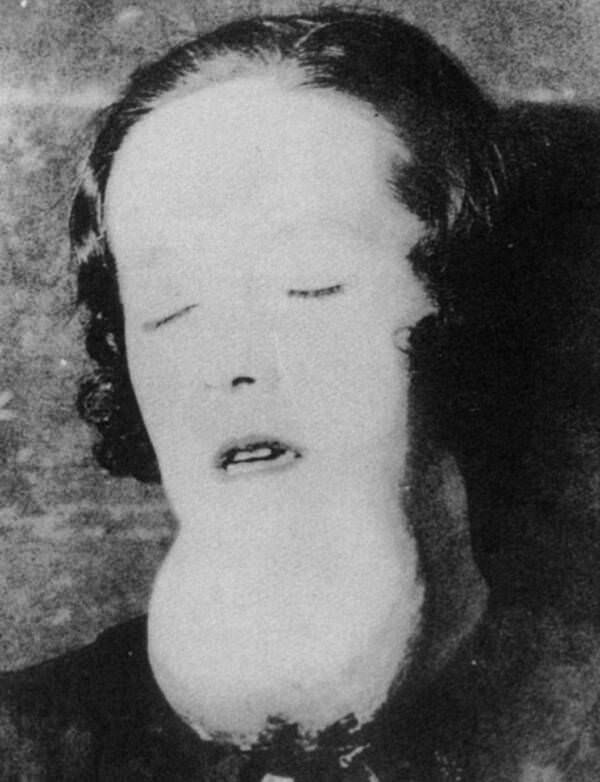 Radium Girls Radium Girls