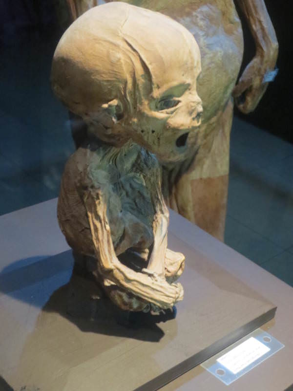 This mummified infant is considered one of the smallest mummies in the museum.