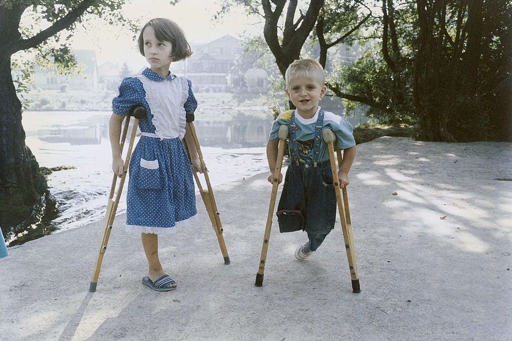 Child victims of war - Sanja, 7, Serbian Orthodox, and Aladdin, 4, Muslim, each lost a leg during the siege of the Bihac enclave.