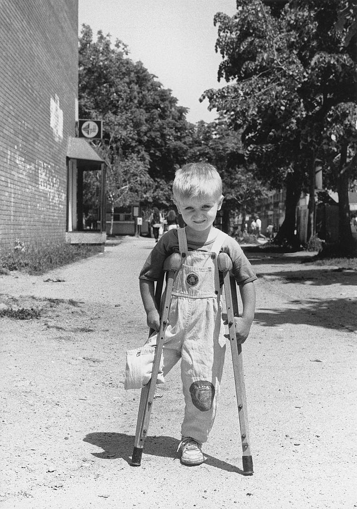 Child victims of war - Aladdin, 4, Muslim, lost a leg during the siege of the Bihac enclave on January 9, 1994.