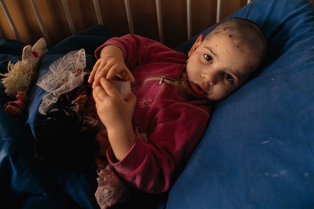 A young child lies in bed and plays with toys while recovering from face wounds received during the siege of Sarajevo
