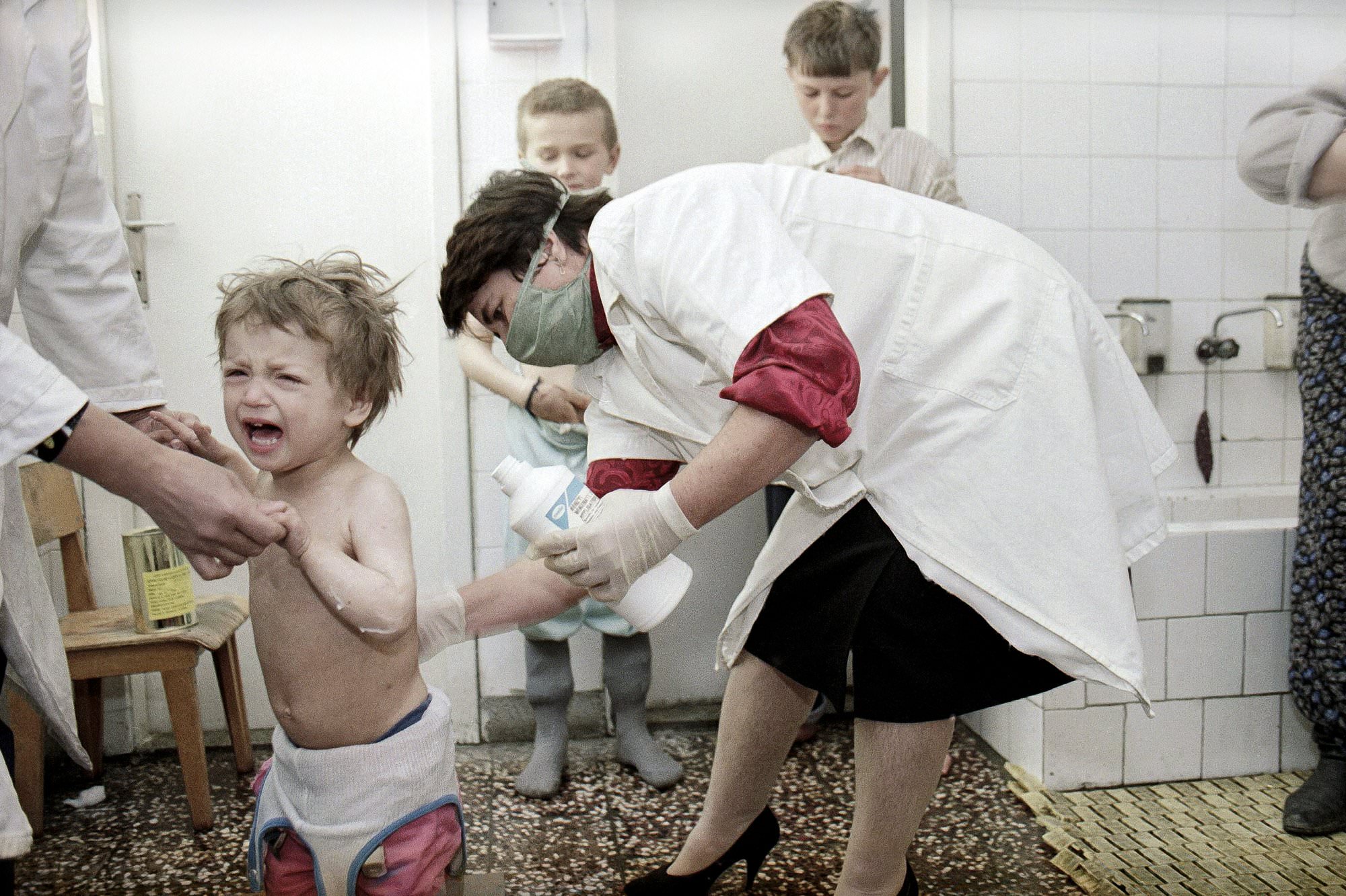 A nurse treats a child refugee from Srebrenica with ointment against measles at the refugee camp in Lukavac, Bosnia, March 23, 1993.