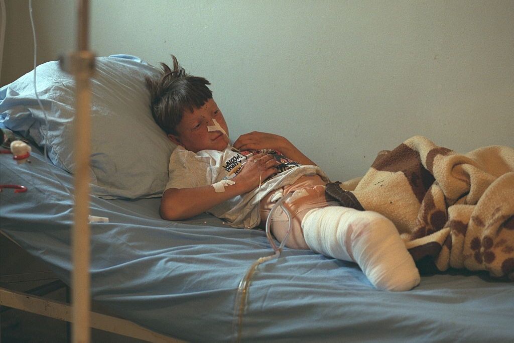 At Prizren hospital, a young boy had to have his foot amputated after stepping on a land-mine.