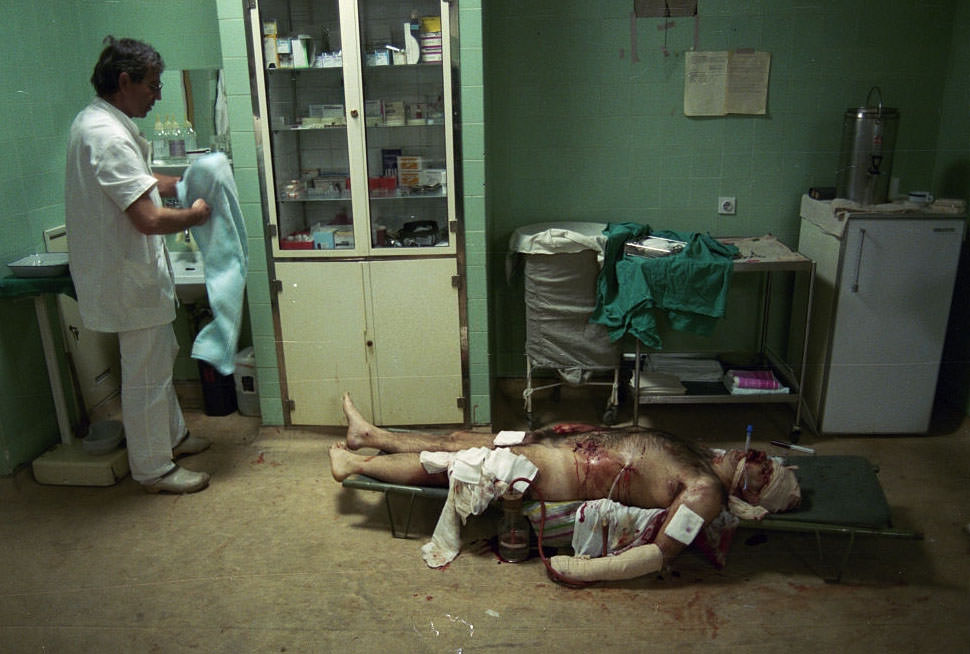 A victim of a Serbian bombing in the center of Sarajevo on the first day of a cease-fire lies seriously injured in a military hospital.