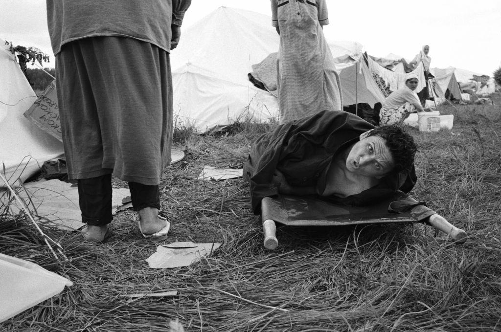 An injured woman at the refugee camp in Tuzla where Muslim women waited in vain for their men to join them.