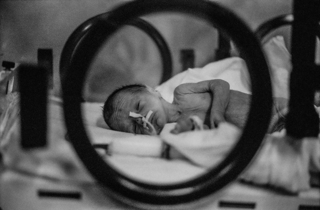 A one year old child in the hospital during the Siege of Sarajevo, 1994.