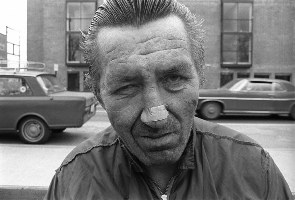 Man with Bandaid on Nose, 1974
