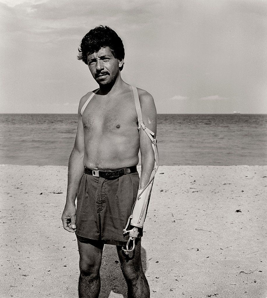 Man with prosthetic arm, Miami Beach, Florida.