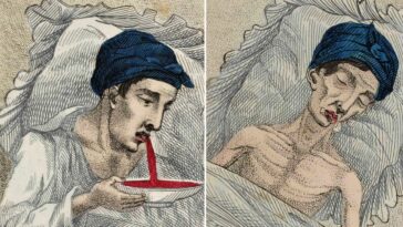 In the 1830s, a Medical Book illustrated the Horrors of Masturbation with a Story of a Young Boy