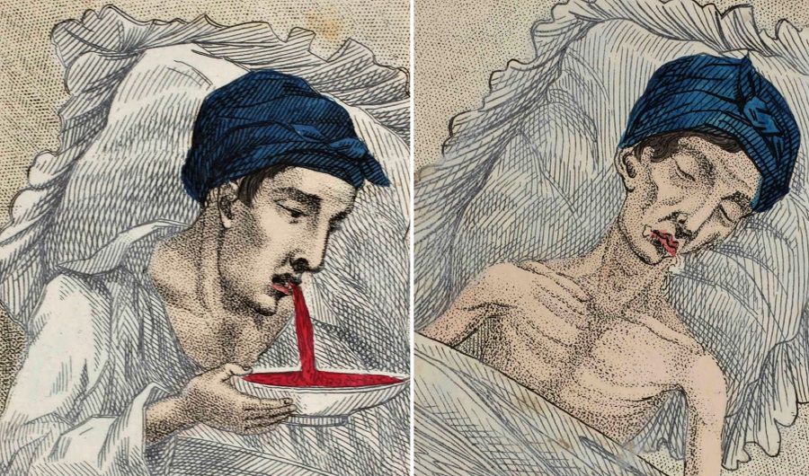 In the 1830s, a Medical Book illustrated the Horrors of Masturbation with a Story of a Young Boy