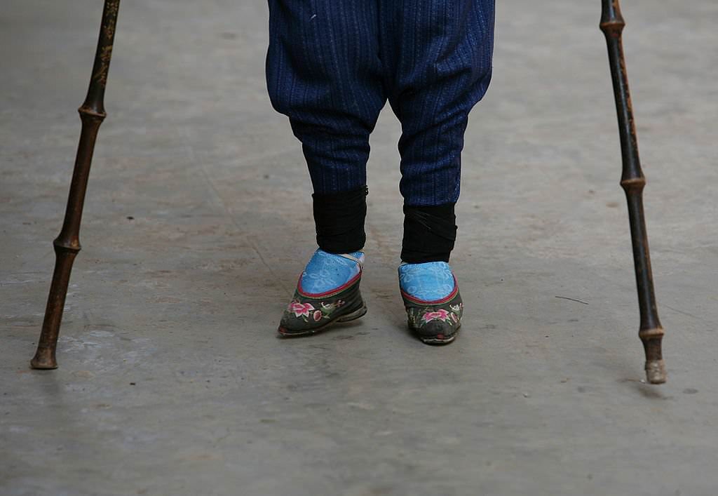 Bound Feet Women in Liuyi Village of Yunnan Province