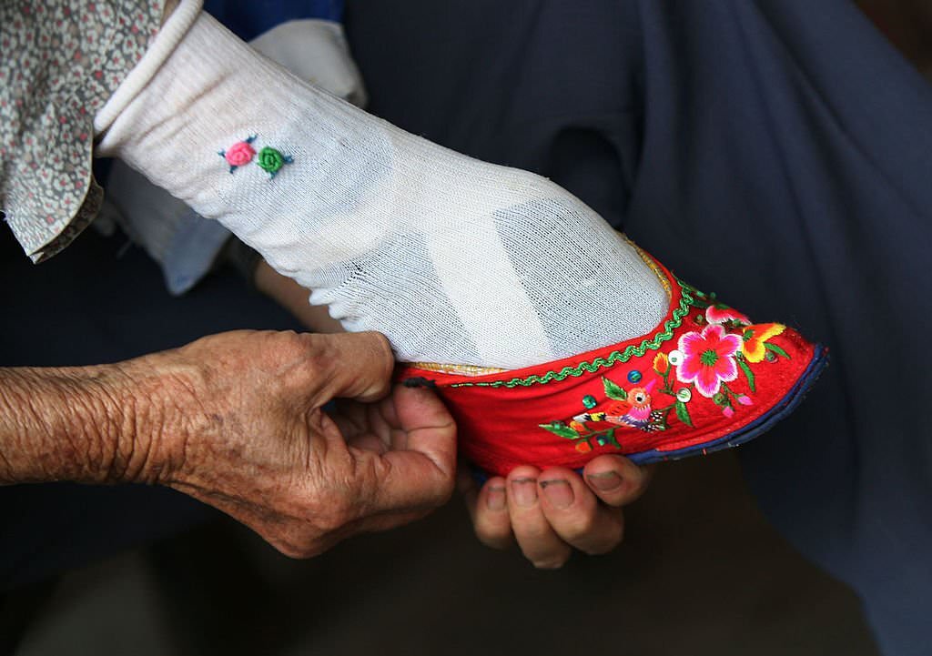 Bound Feet Women in Liuyi Village of Yunnan Province