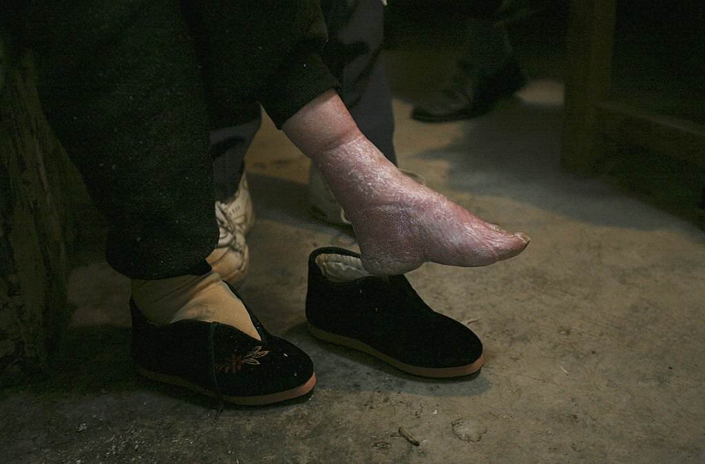 Bound Feet Chinese Women.