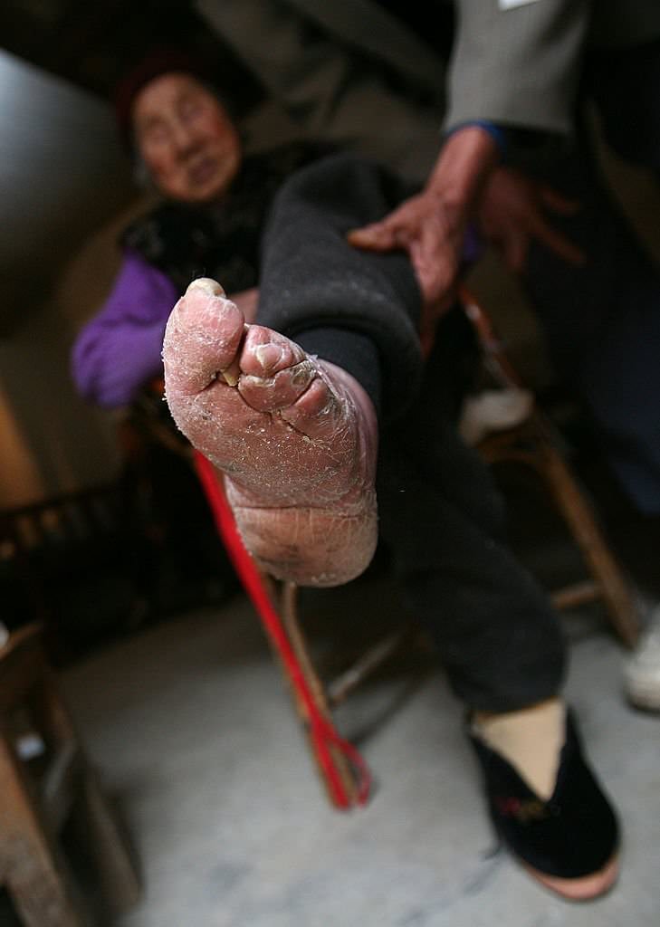 Bound Feet Women in Liuyi Village