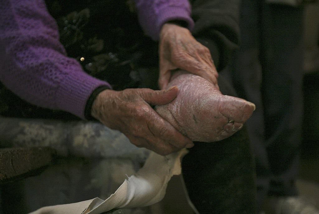 100-year-old bound feet woman, whose surname is Luo Pu, 2007.