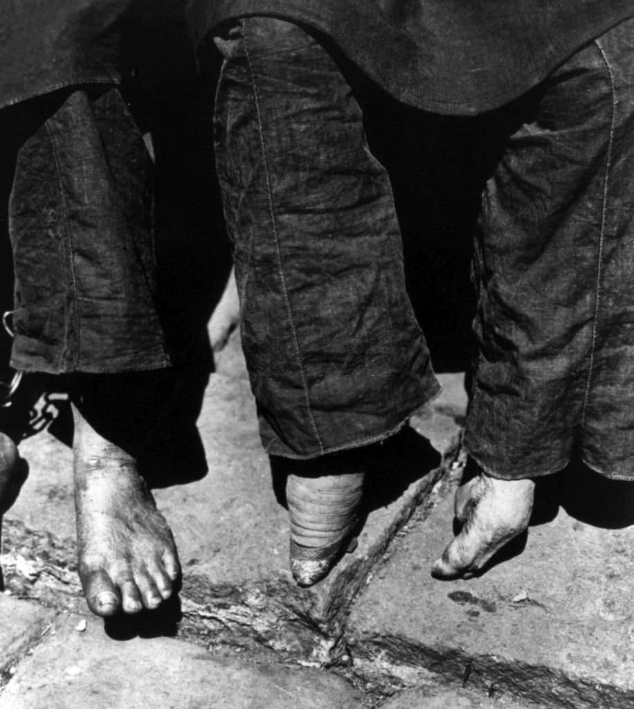 China: Unbound feet (left) compared with bound 'lily' feet (right), C H Graves, 1902