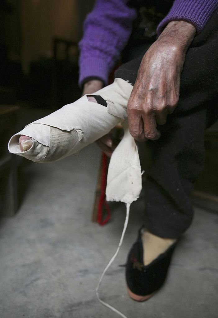 Bound Feet Women in Liuyi Village Of Yunnan Province