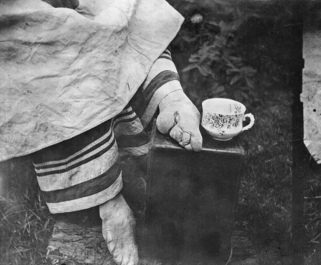 hinese woman, whose feet have been bound, rests on a carved stone bench in Beijing, China in February, 1984.