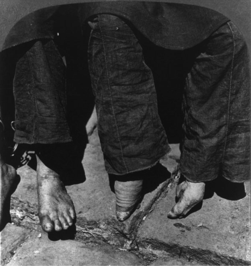 Bound Feet: Horrible Body Modification that Chinese Women Practiced for One Thousand years