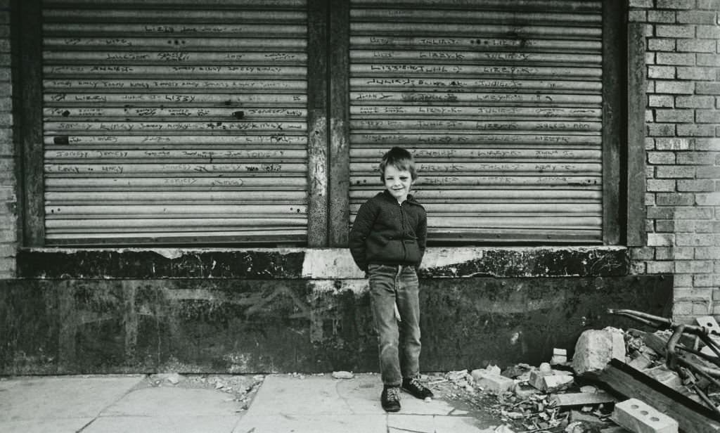 A young boy with a black eye standing on the street in Liverpool, 1982.