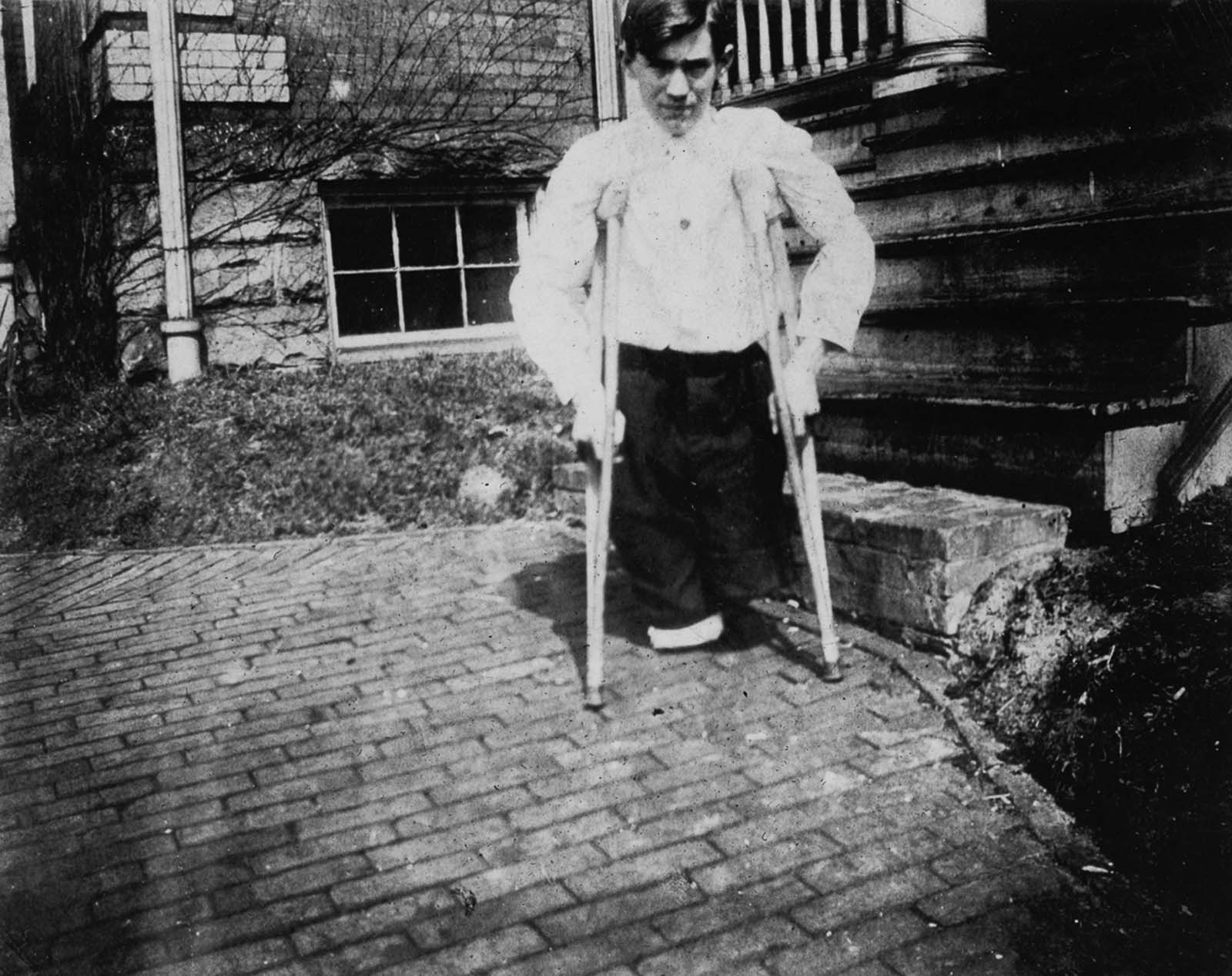 Nola McKinney, whose legs were cut off by a motor car in a coal mine in West Virginia when he was 14 years old, 1910