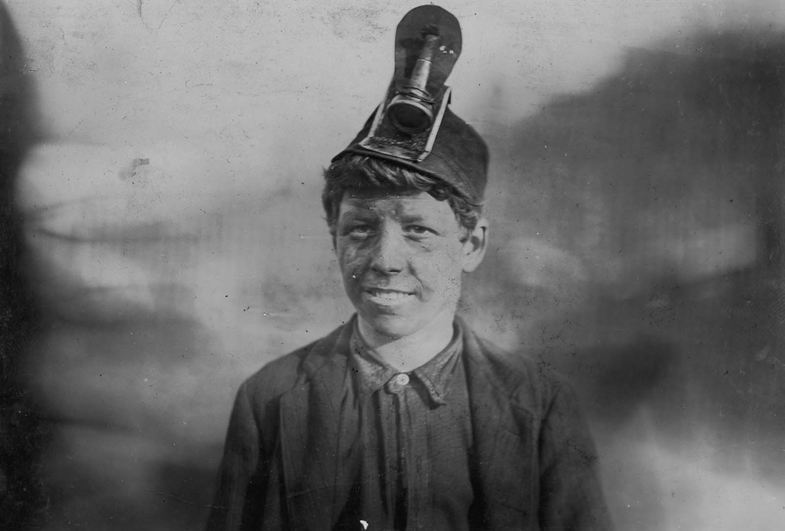 Frank, age 14. He had been working in a mine for three years and had been hospitalized for a year when his leg was crushed by a coal car, 1906