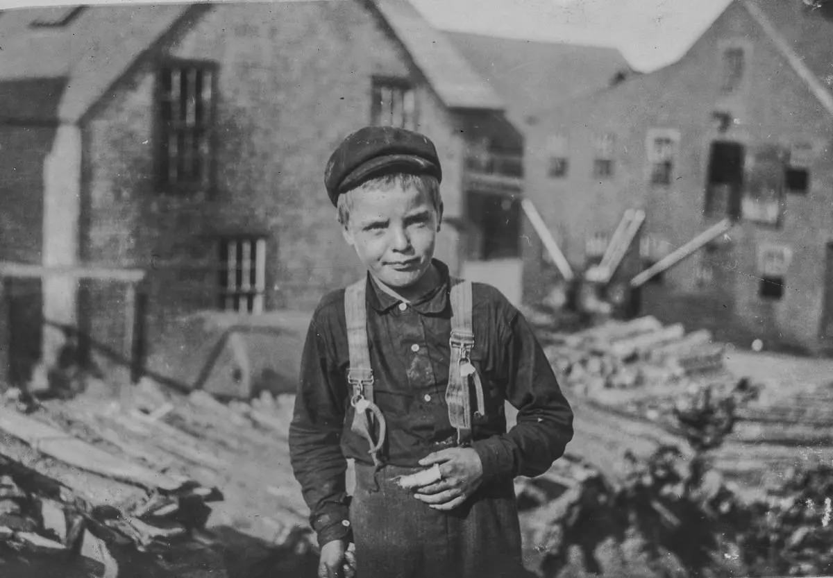 Richard Mills, eight years old, showing a severely cut finger.”