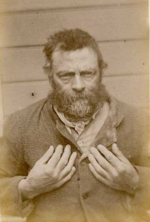 Bernard Herman (b. 1836, Ireland). Charged with embezzlement and sentenced to 6 months on February 21, 1889 (Christchurch). Described as having scars on his right leg and his back, and a deformed right little finger.