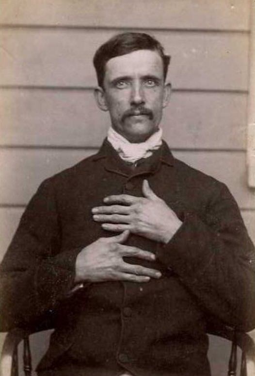 Charles Fowler (b. 1851, England). Charged with housebreaking and sentenced to 5 years on October 6, 1888 (Dunedin). A cook by trade. Described as having no middle finger on his right hand and missing front teeth, 1888