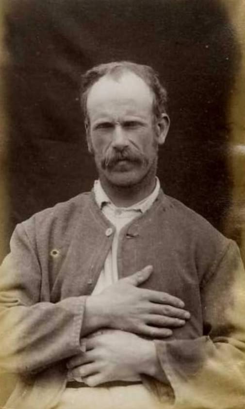 Charles Stevens (b. 1861, Ireland). Charged with larceny and sentenced to 6 weeks on March 7, 1887 (Woodside). Described as a traveler, with his left hand contracted, 1887