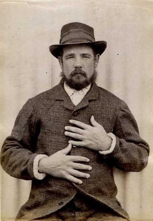 Edwin Hillcock (b. 1860, England). Charged with 2 counts of larceny and sentenced to 12 months on April 24, 1888 (Timaru). A farmer, with a mark of cut on little finger of left hand, 1889