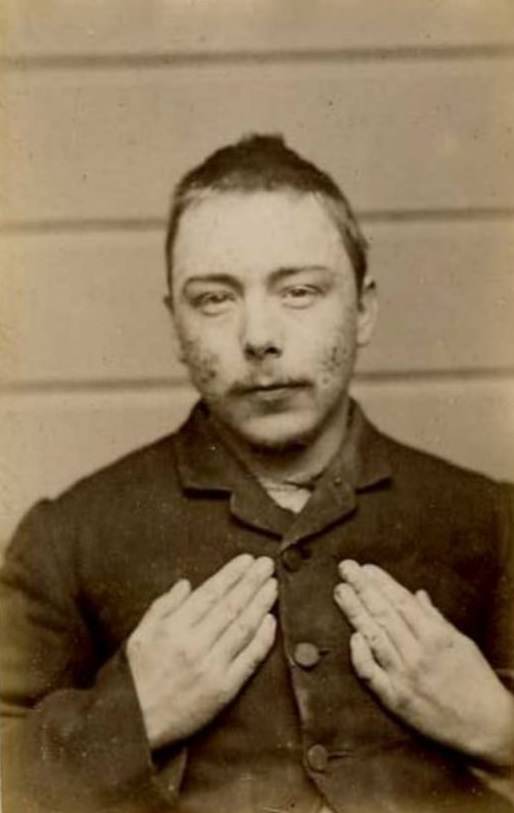 Frank Chaplaw, alias Claplaw/Claphaw/Challis (b. 1866, England). Charged with 5 counts of false pretenses and sentenced to 3 months on each charge. Both hands crooked, 1889