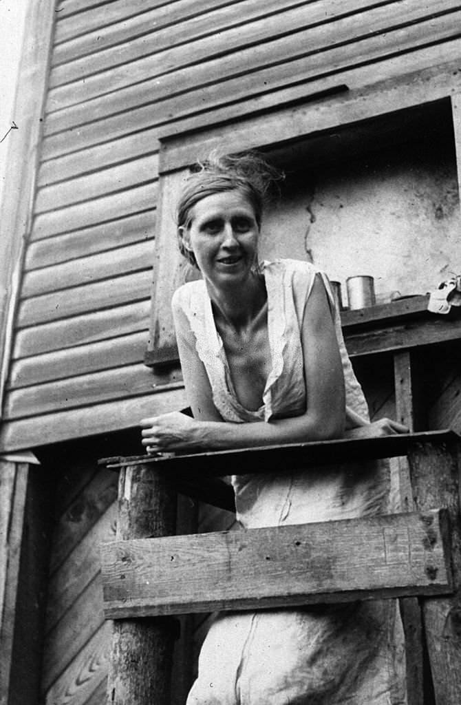 The tubercular wife of an unemployed coal miner in their home, an old company store, in Marine, West Virginia, 1938