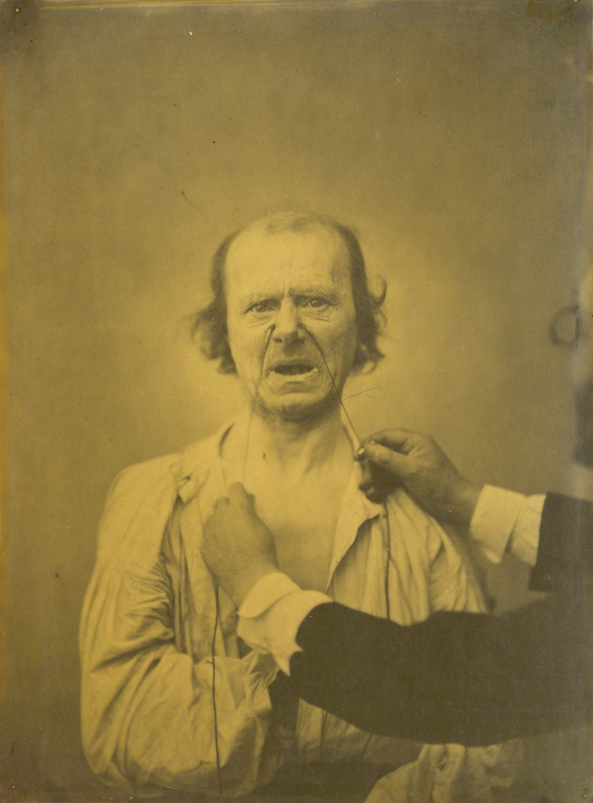 Guillaume-Benjamin-Amant Duchenne (de Boulogne), Discontent, bad humor, 1854-1856