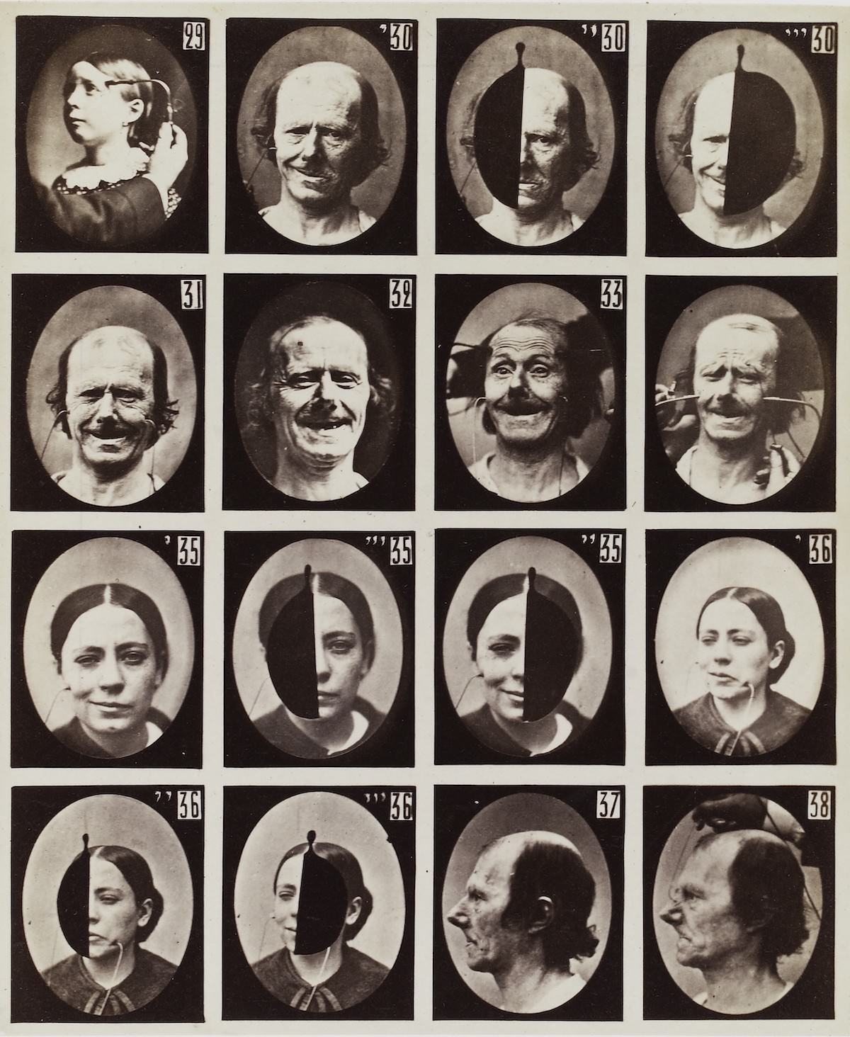 Stunning Illustrations from the Mechanism of Human Physiognomy by Guillaume-Benjamin-Amand Duchenne de Boulogne