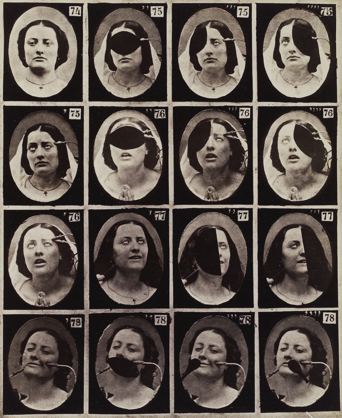 Stunning Illustrations from the Mechanism of Human Physiognomy by Guillaume-Benjamin-Amand Duchenne de Boulogne