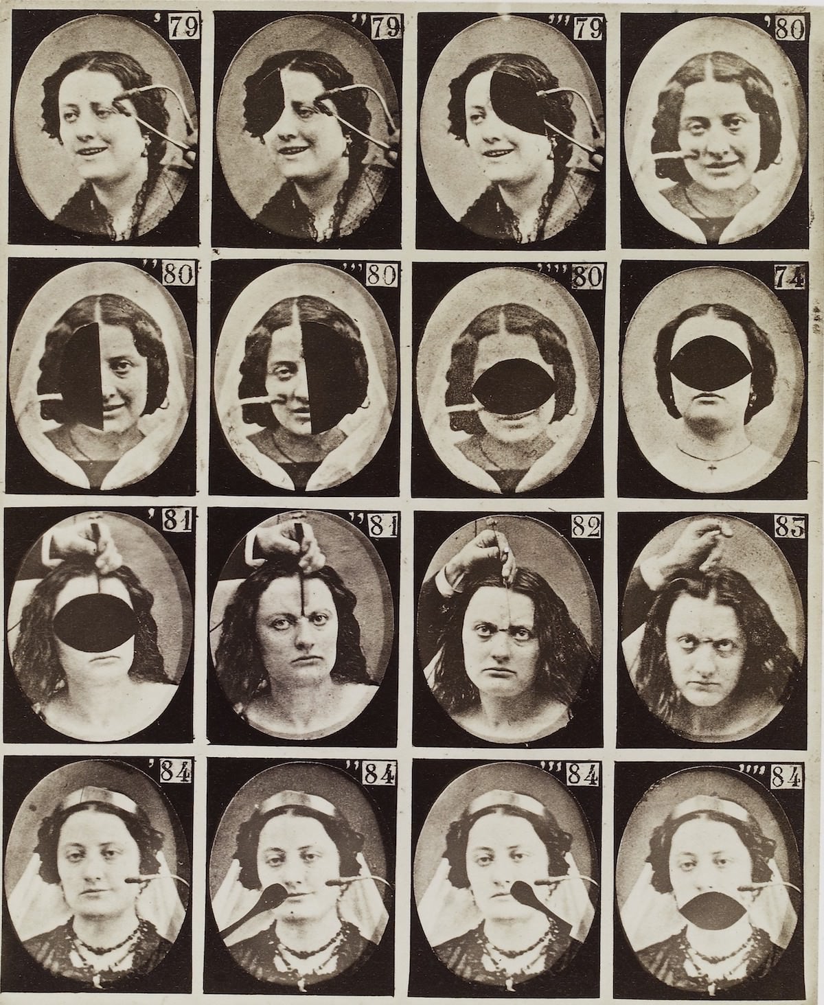 Stunning Illustrations from the Mechanism of Human Physiognomy by Guillaume-Benjamin-Amand Duchenne de Boulogne