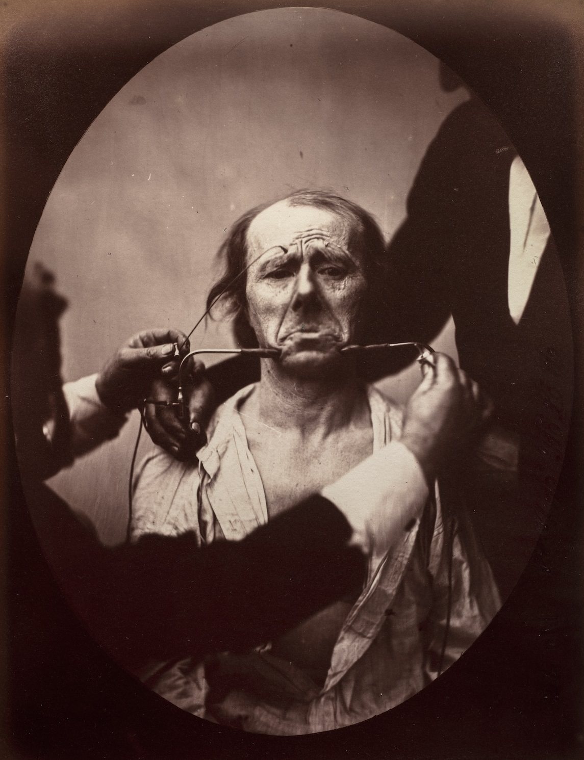 Stunning Illustrations from the Mechanism of Human Physiognomy by Guillaume-Benjamin-Amand Duchenne de Boulogne