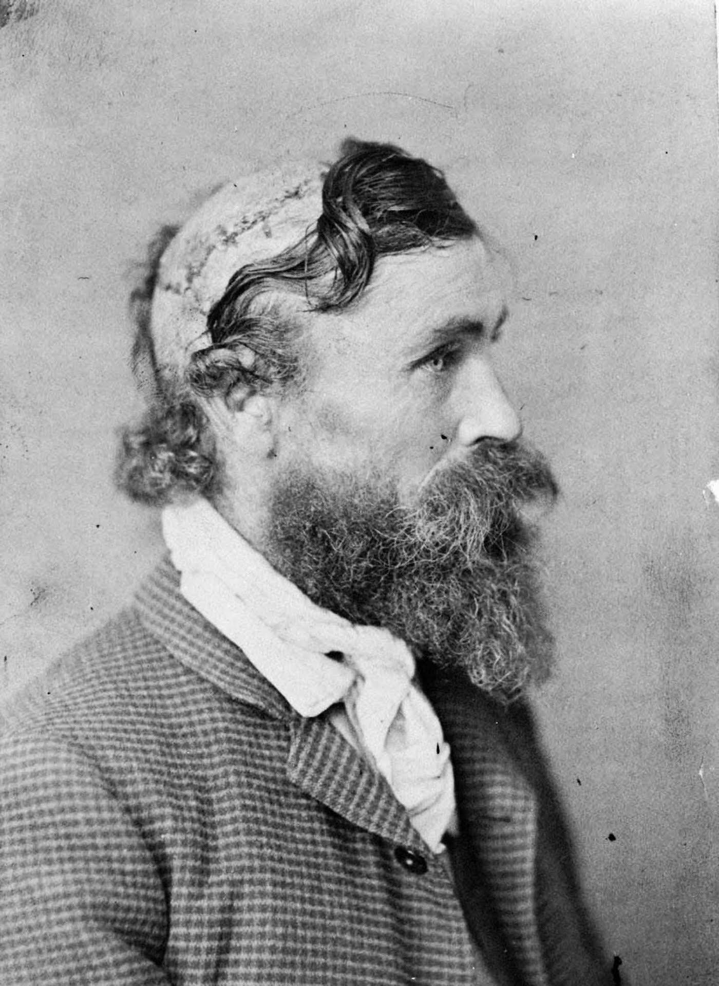 The Remarkable Story of Robert McGee: The Boy Who Survived a Native American Scalping
