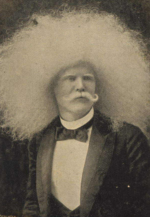 The Striking Story of Unzie: Australia's Albino Aborigine Man