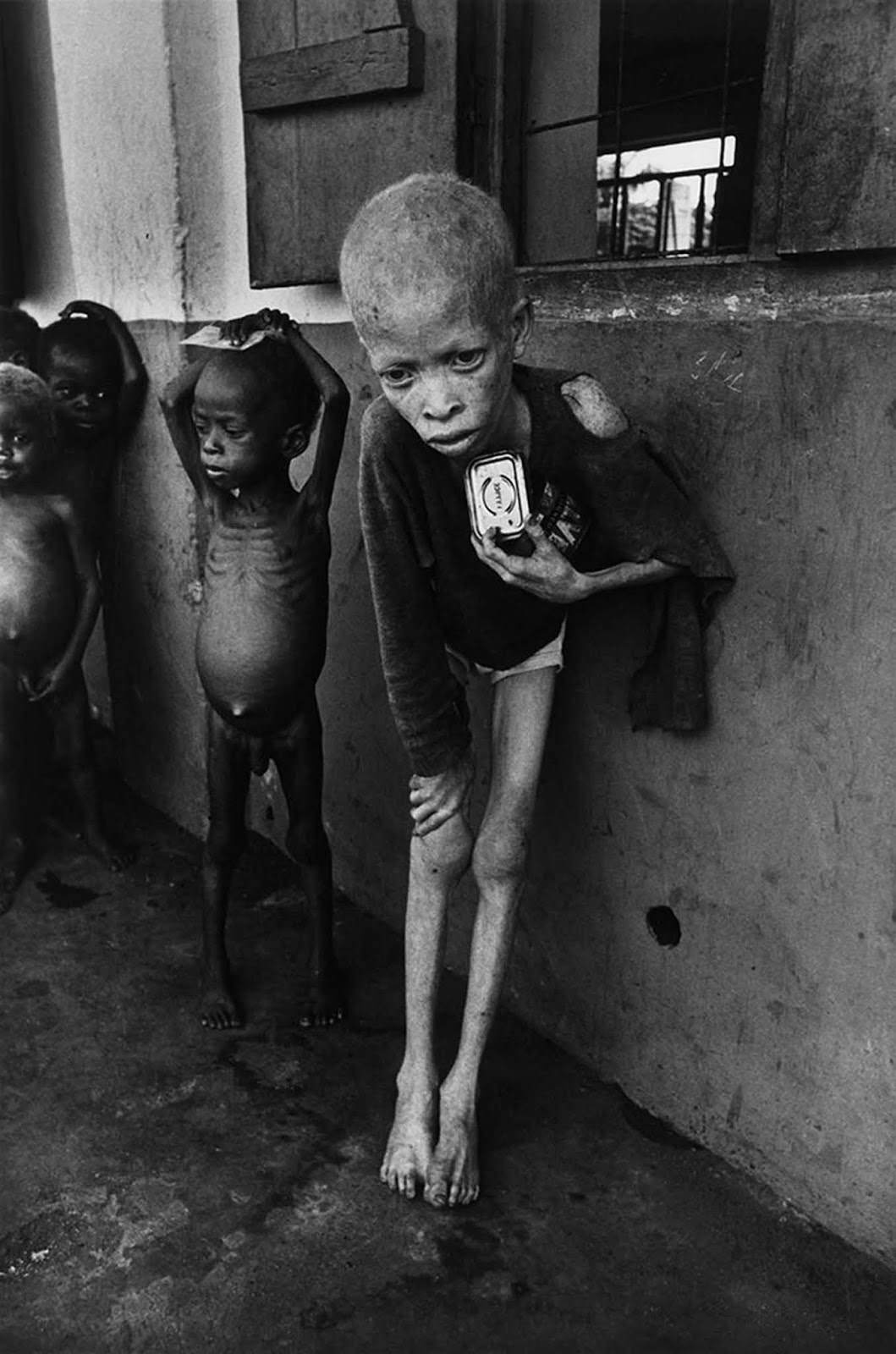 Albino Boy, Biafra, 1969