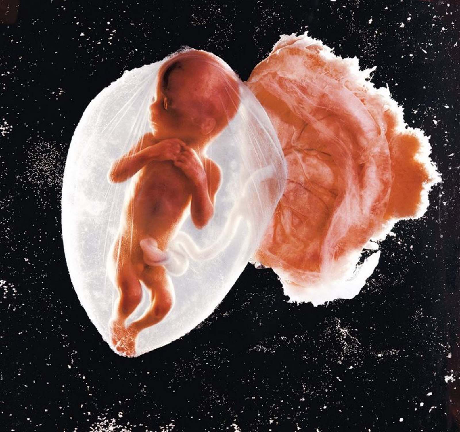 Fetus, 18 Weeks, 1965