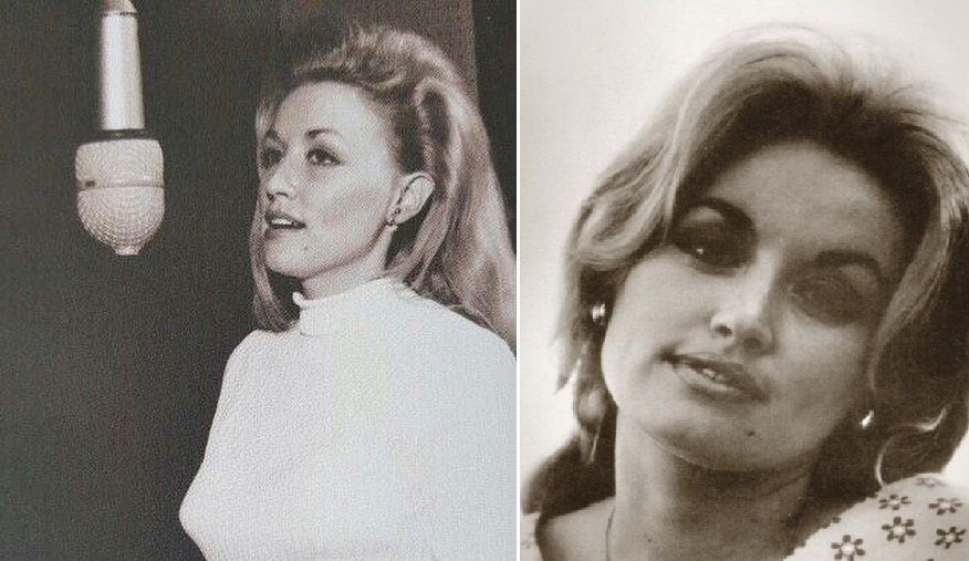 What Does Dolly Parton Look Like Without Wigs Revealing Her Natural Hair