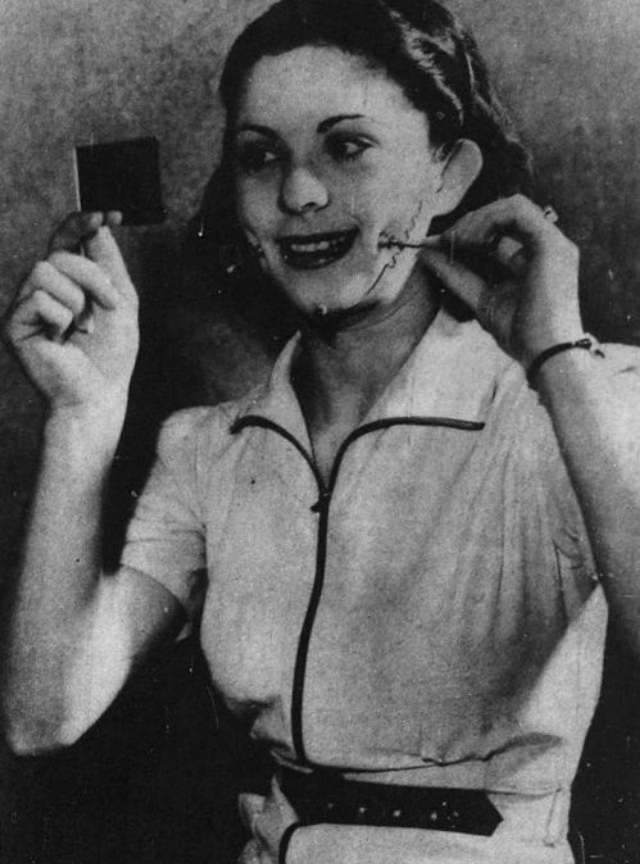 The Bizarre Beauty Contraption from 1936 that Promised Dimples