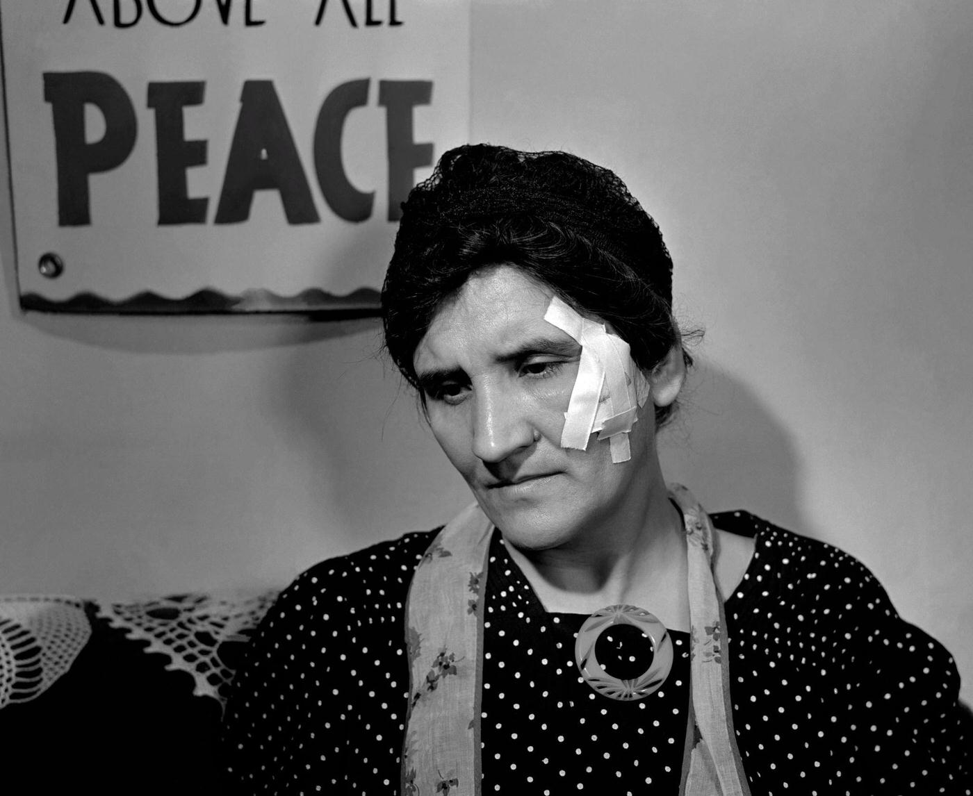 An unidentified woman sits with an injury under a sign that reads, Above All Peace during the Detroit Ford Motor Company strike at the River Rouge plant in Dearborn, Michigan, April 1941.