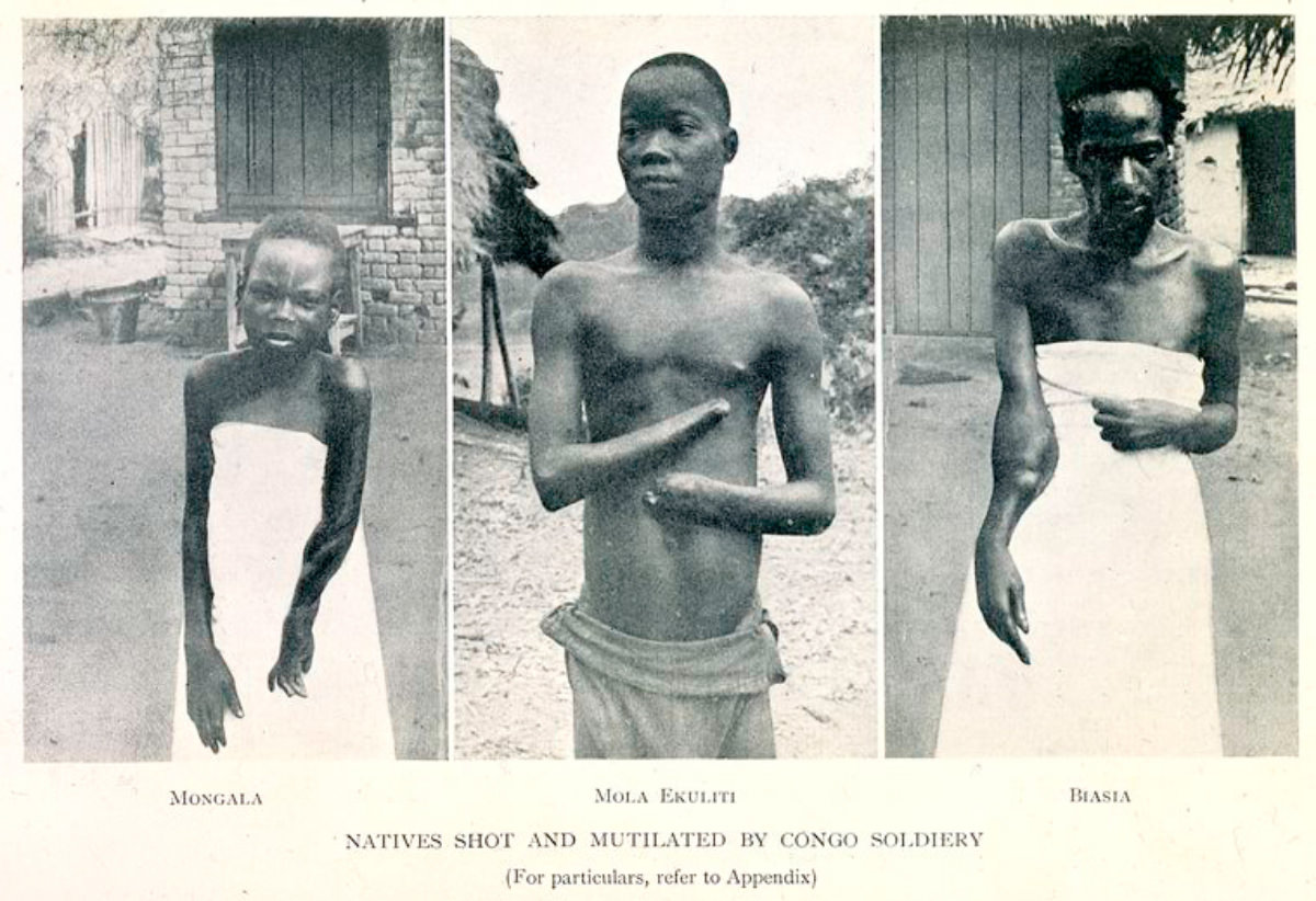 The Belgian Congo's Hacked Hands: A Brutal Reminder of Colonial Atrocities