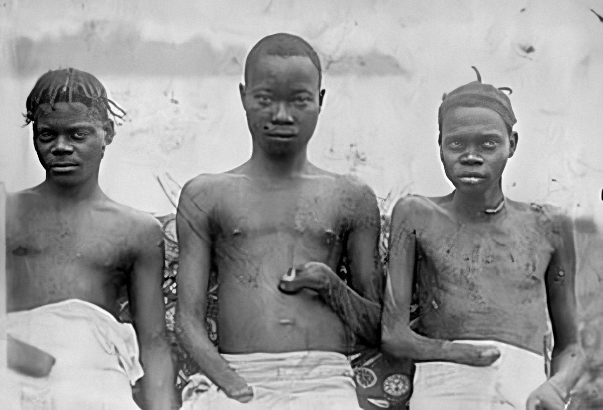 The Belgian Congo's Hacked Hands: A Brutal Reminder of Colonial Atrocities