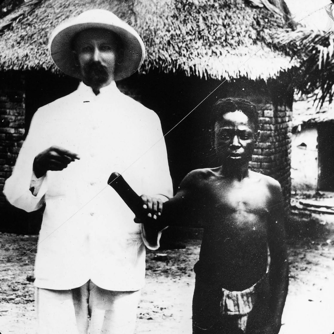 The Belgian Congo's Hacked Hands: A Brutal Reminder of Colonial Atrocities