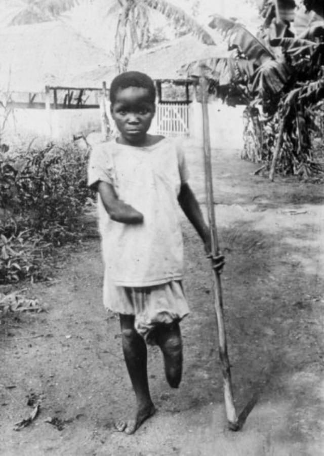 The Belgian Congo's Hacked Hands: A Brutal Reminder of Colonial Atrocities